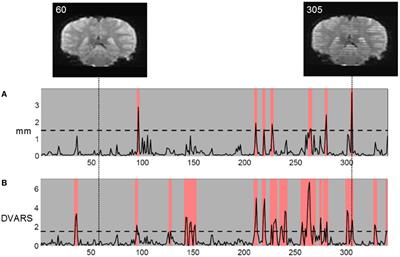 Are Movement Artifacts in Magnetic Resonance Imaging a Real Problem?—A Narrative Review